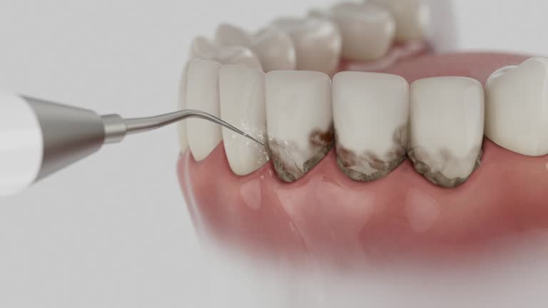Reliable Emergency Dentist contractor in Millbrae, CA by Smile Center Dentistry